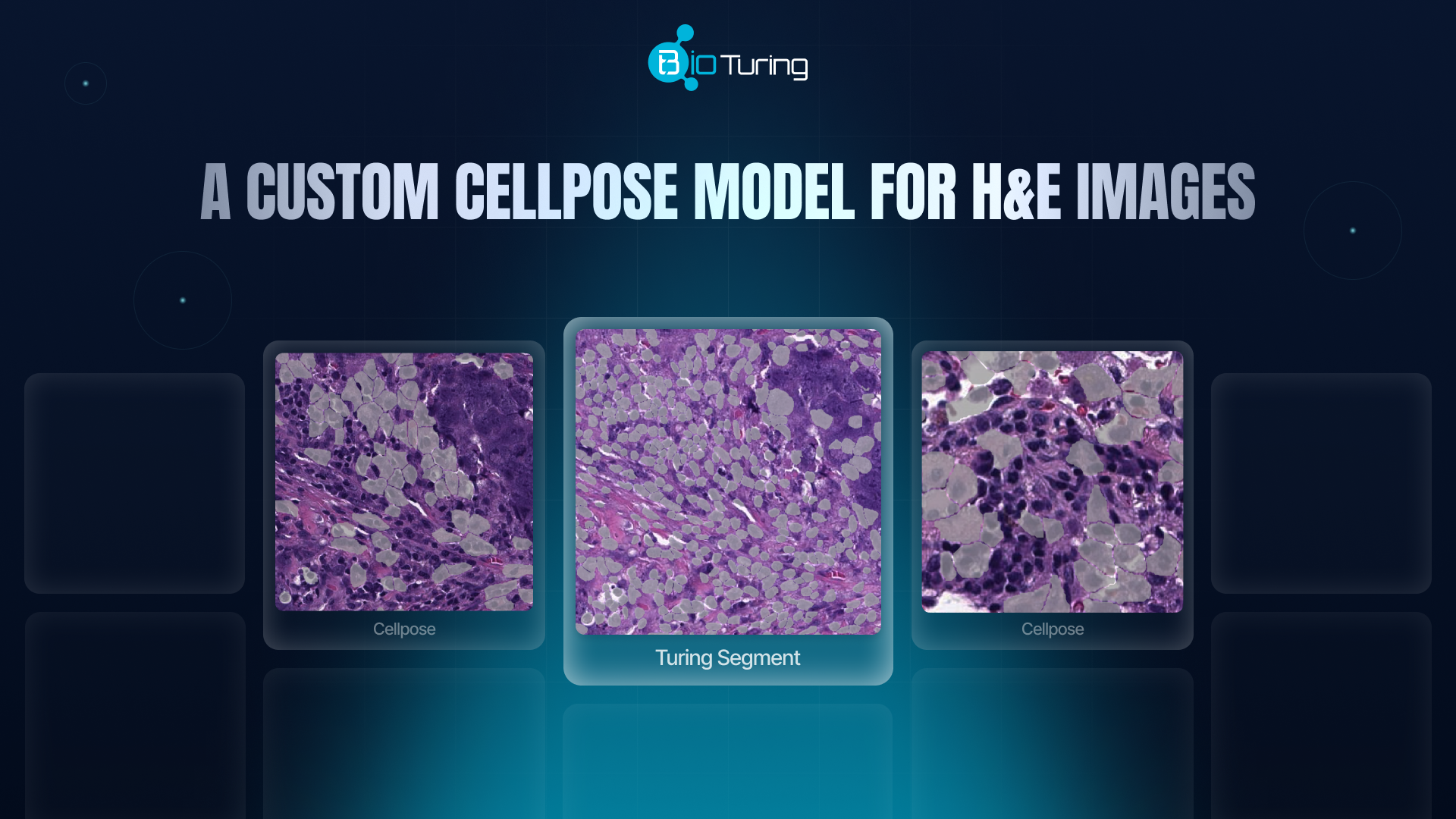 A custom Cellpose model for H&E images