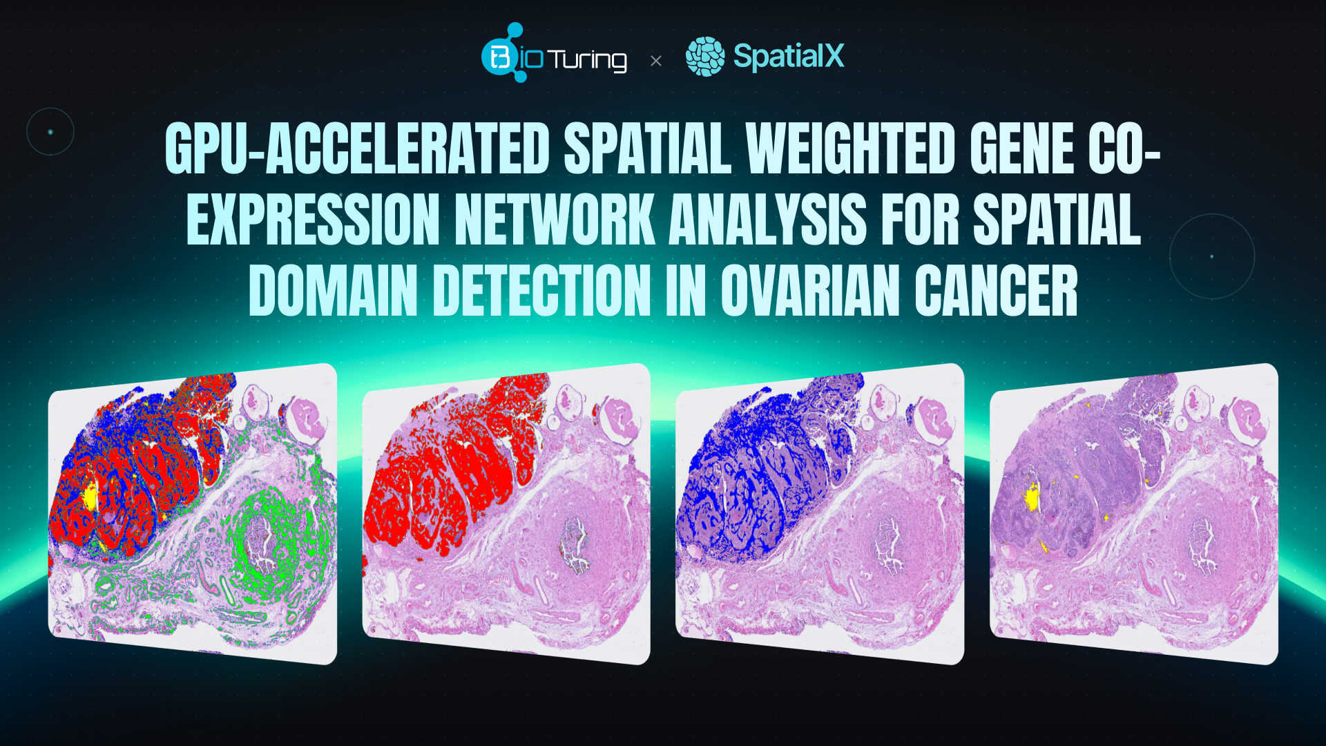 GPU-Accelerated Spatial Weighted Gene Co-expression Network Analysis for Spatial Domain Detection in Ovarian Cancer thumbnail