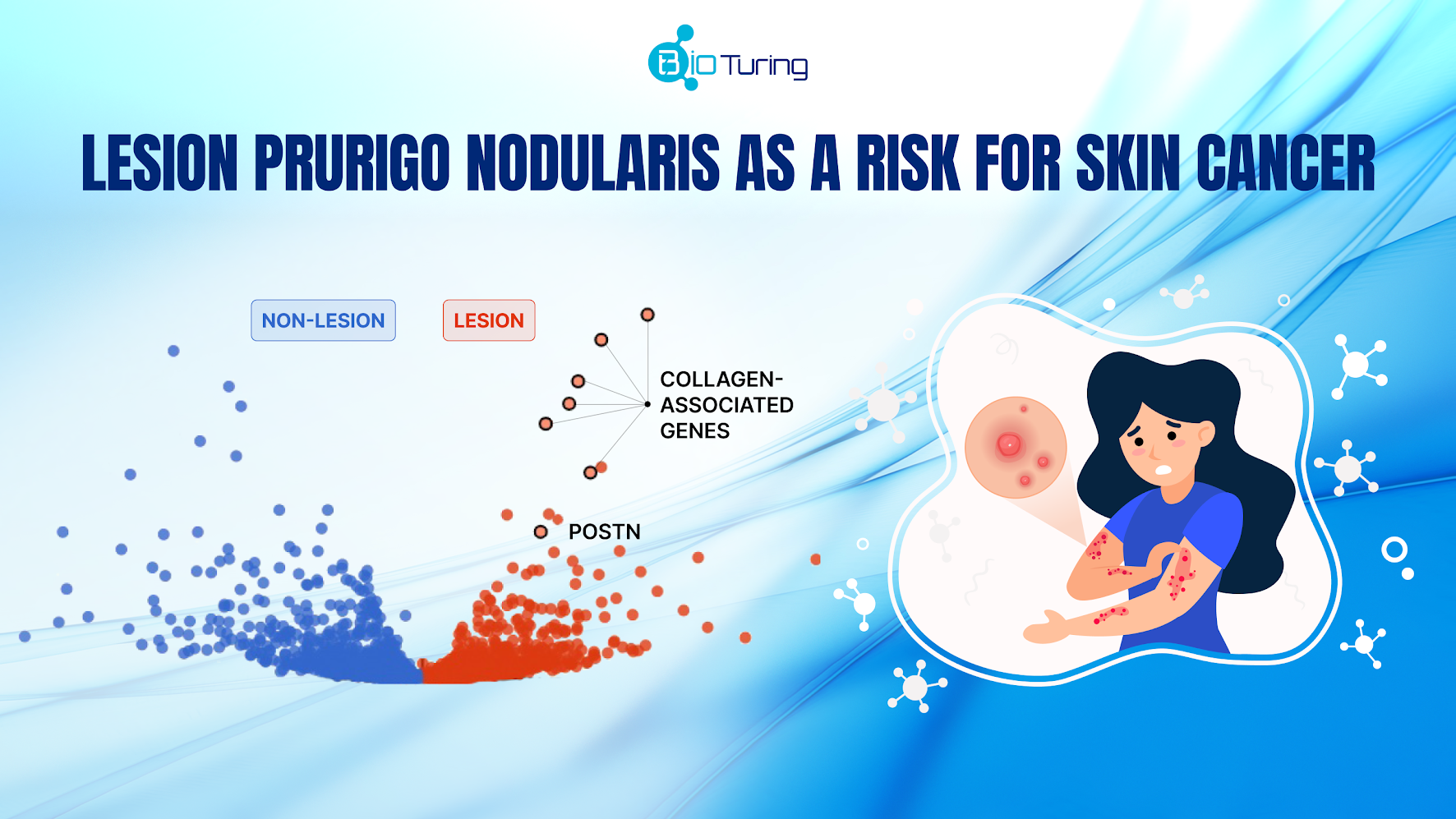 Lesion prurigo nodularis as a risk for skin cancer thumbnail