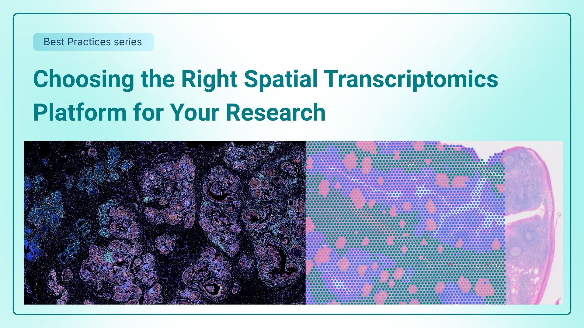 Choosing the Right Spatial Transcriptomics Platform for Your Research thumbnail