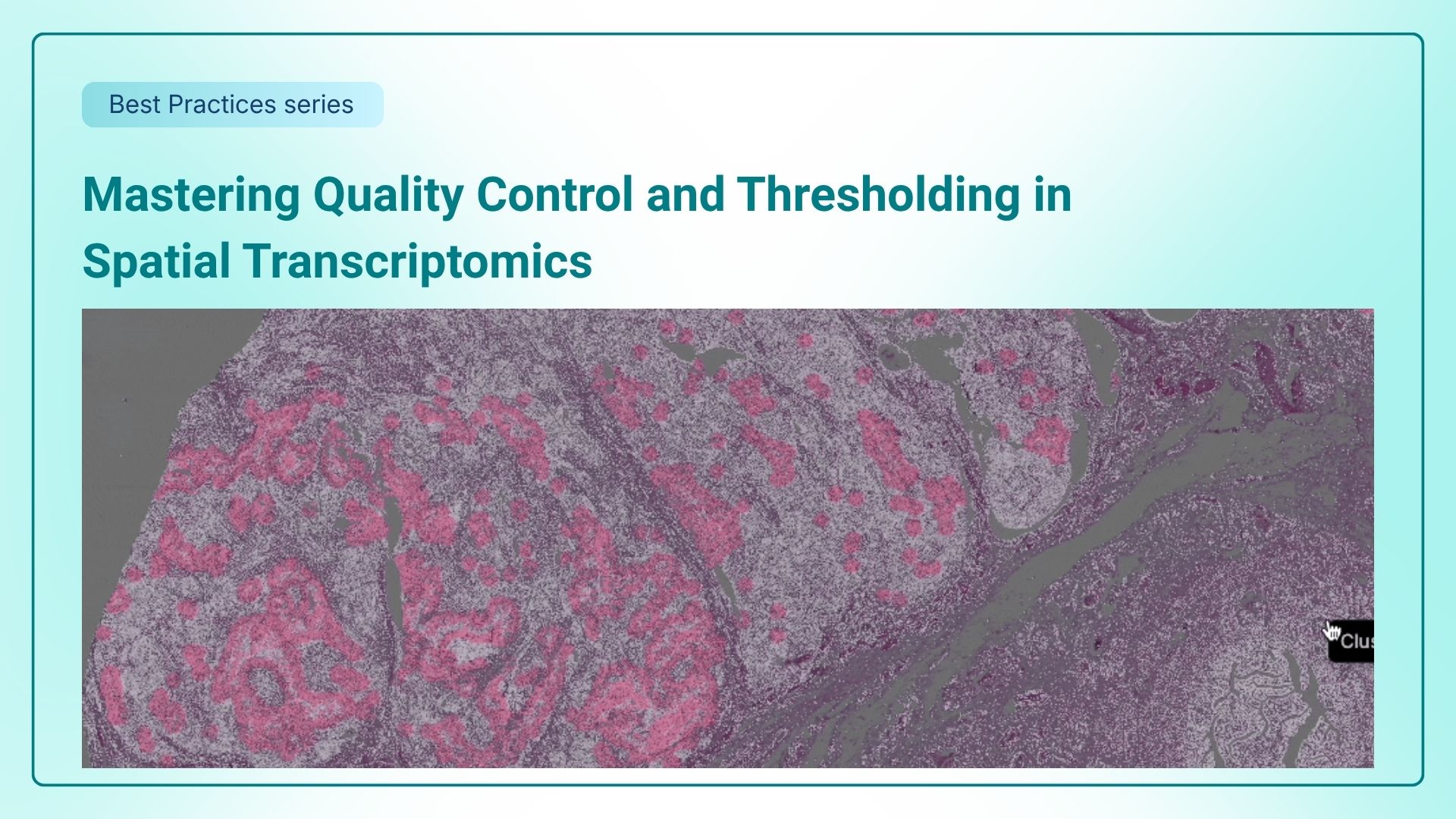 Mastering Quality Control and Thresholding in Spatial Transcriptomics thumbnail